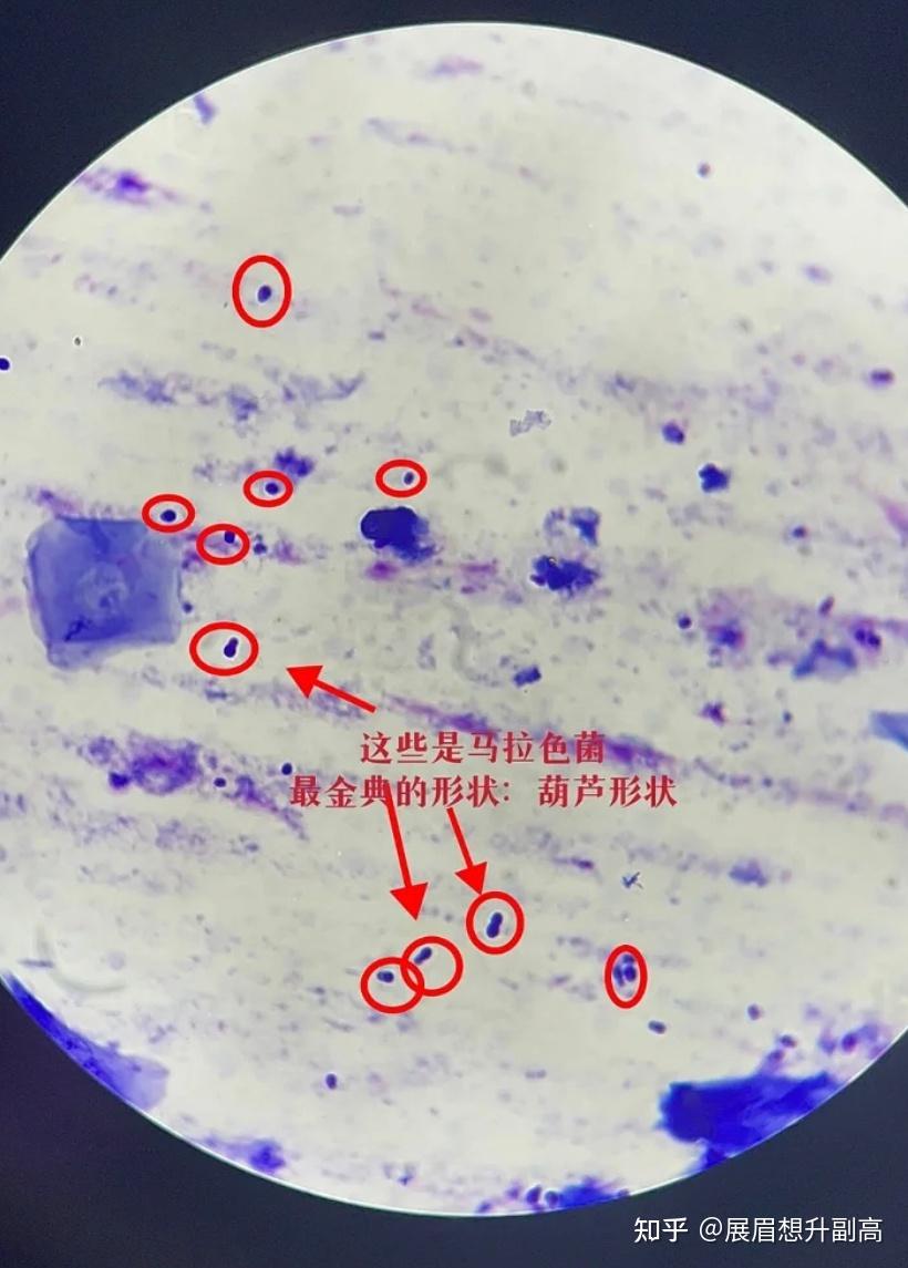 有什么好用的洗发水推荐一下