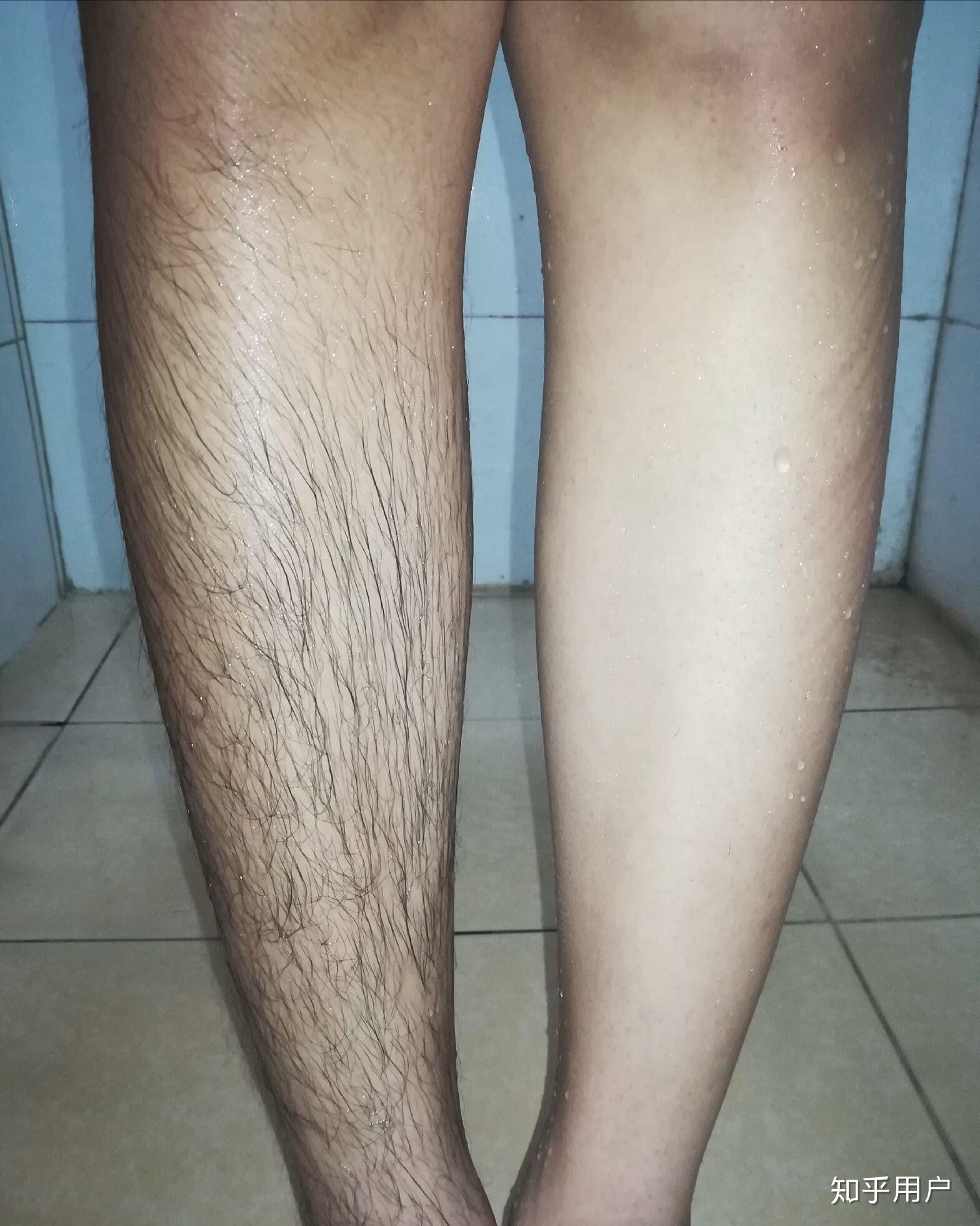 男生穿短裤要不要刮腿毛腿毛重