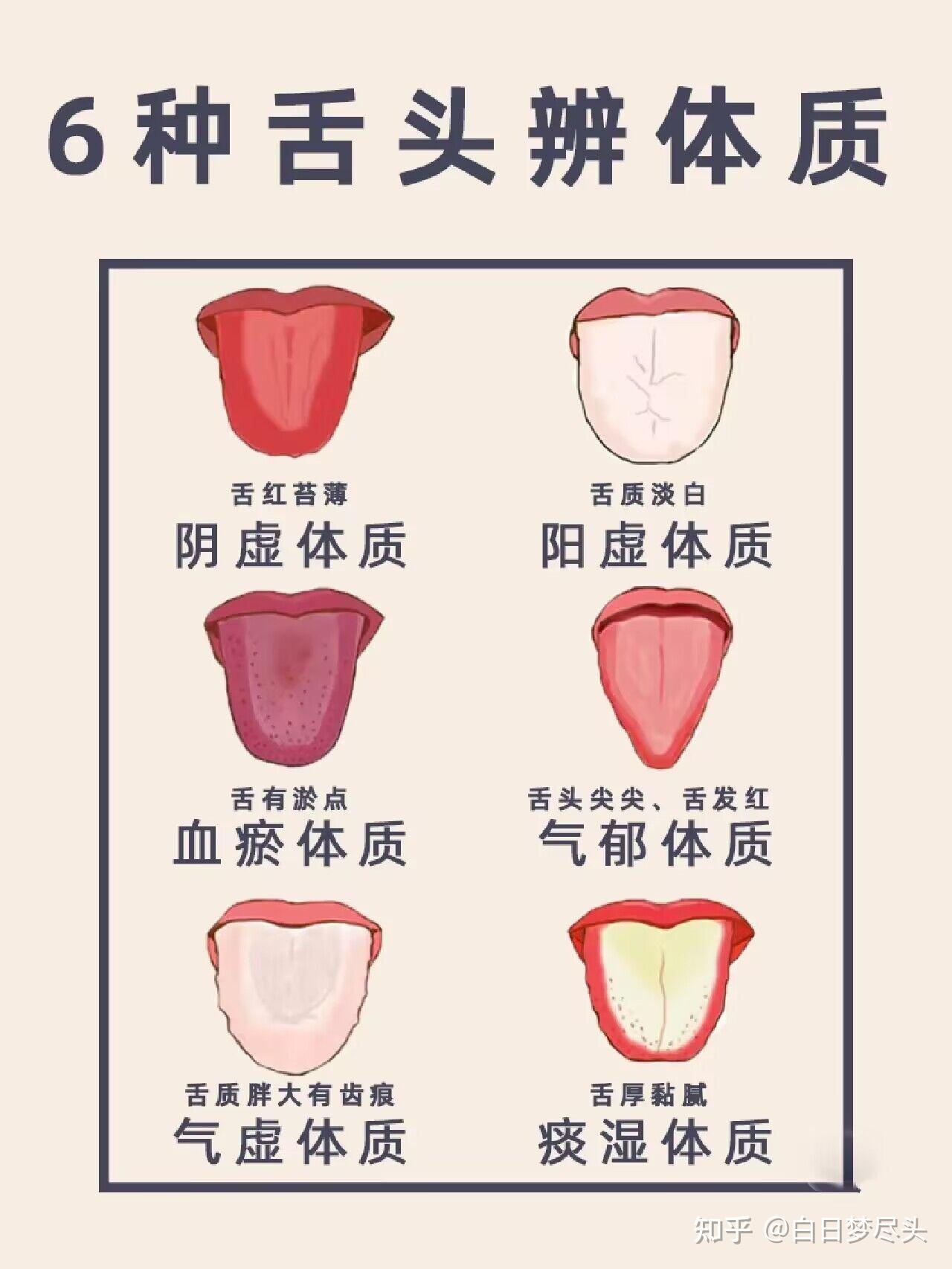 从舌苔看健康 跟中医学舌诊 - 知乎