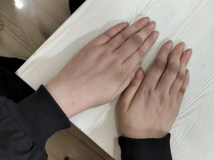 类风湿别在闷头吃药了,从免疫平衡入手,轻松告别关节疼痛! - 知乎