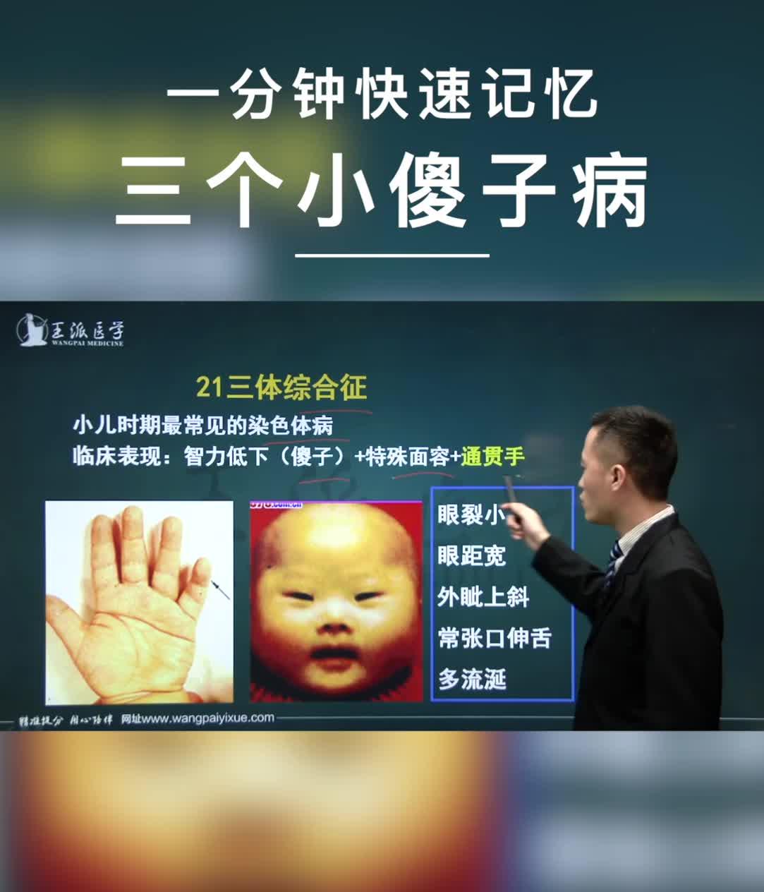 二十一三体综合症会有什么表现,会有异于常人的天赋么?