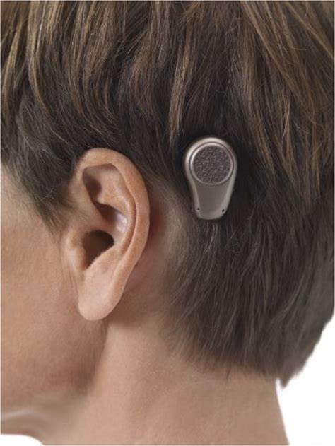 骨导助听器的工作原理是什么效果好不好