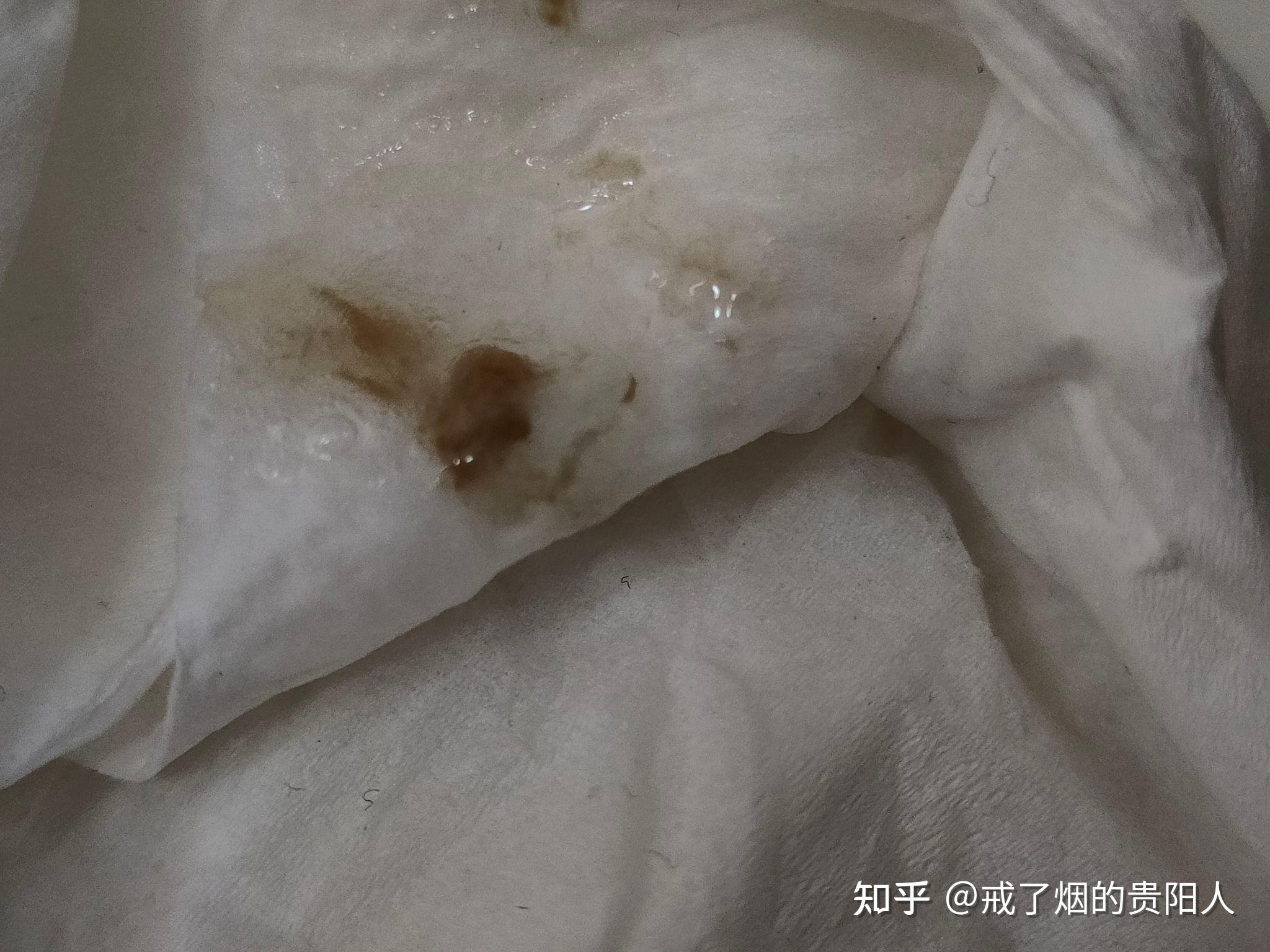 戒烟后吐出来的黑痰是什么物质