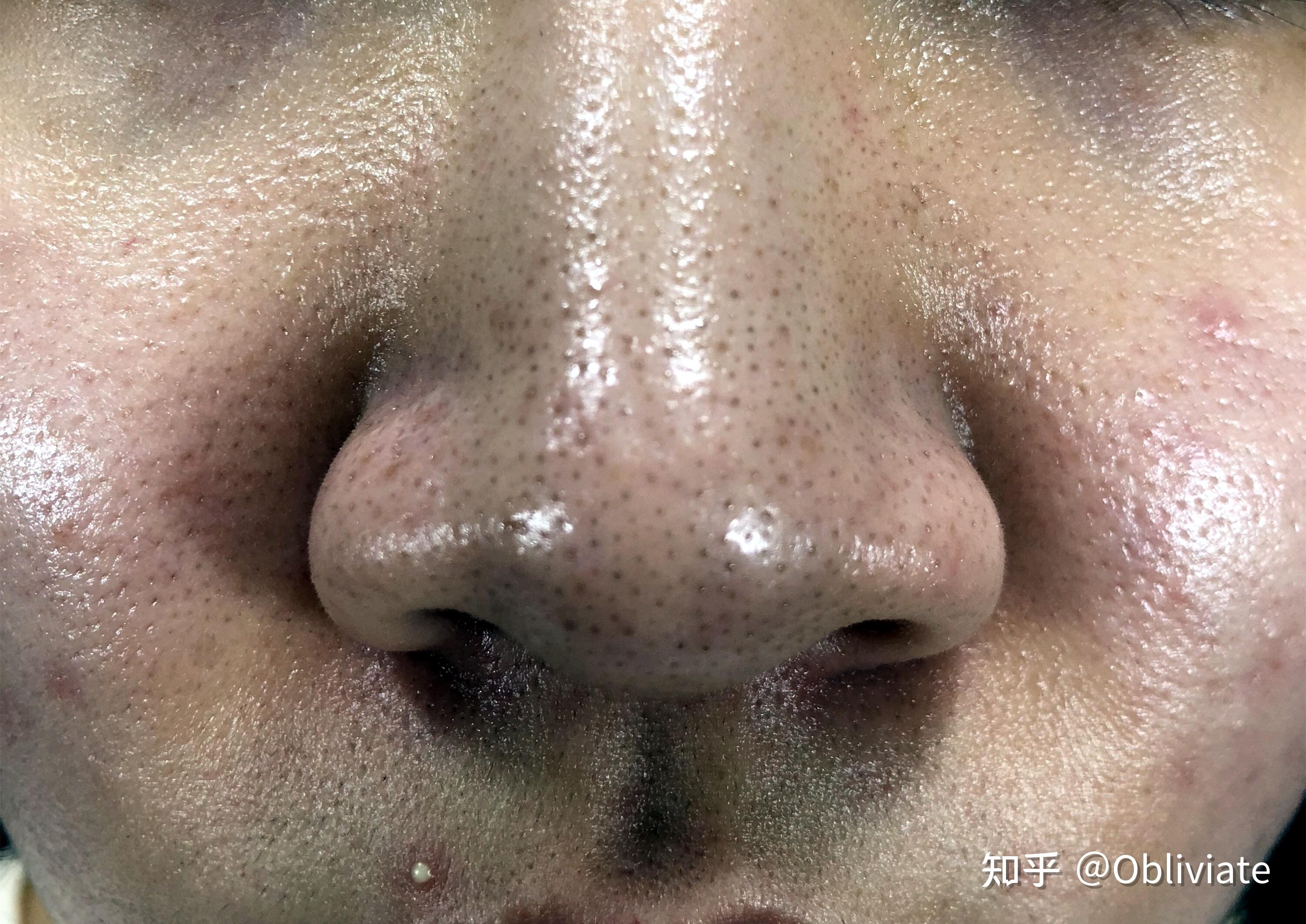 为什么天天洗脸还是看起来脏脏的