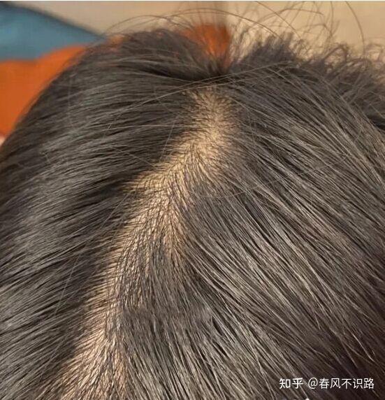 怎么使头发变得柔顺? - 知乎