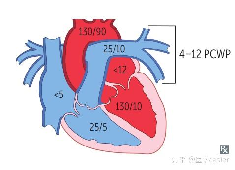 为什么临床上心房纤维性颤动引起心输出量减少而心室纤维颤动则可因