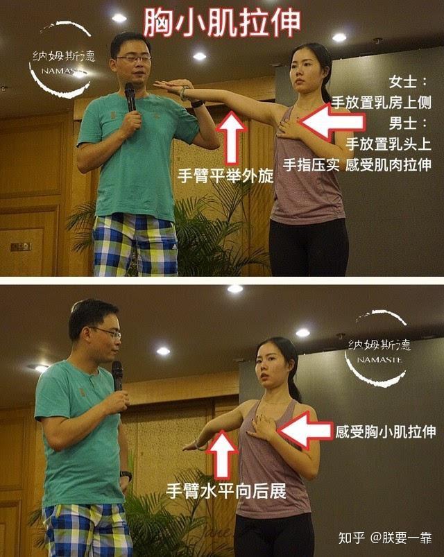 长期驼背导致的肩胛骨突出头前伸的状态如何通过背部锻炼矫正