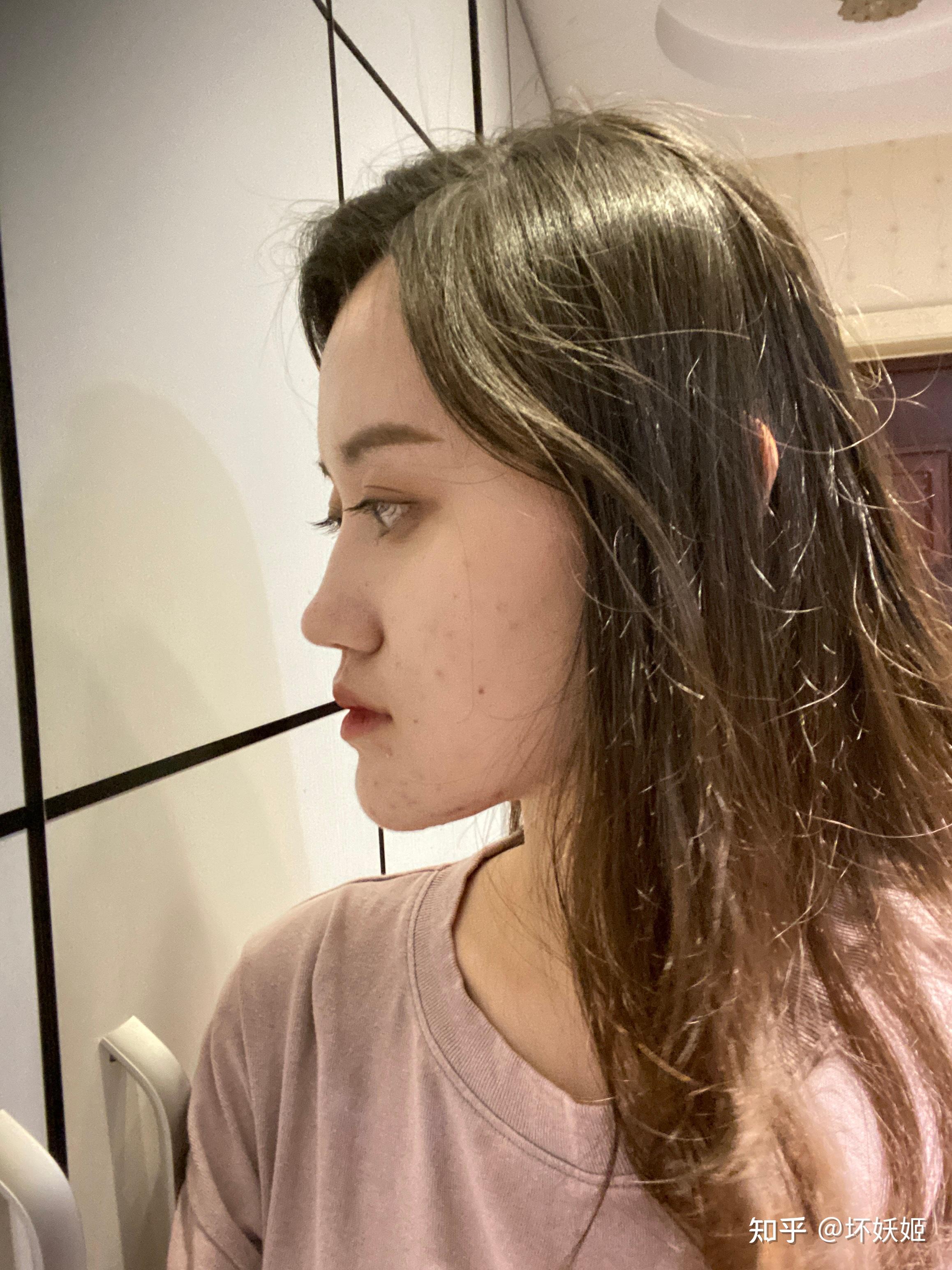 翘下巴月亮脸鞋拔子脸是不是很丑