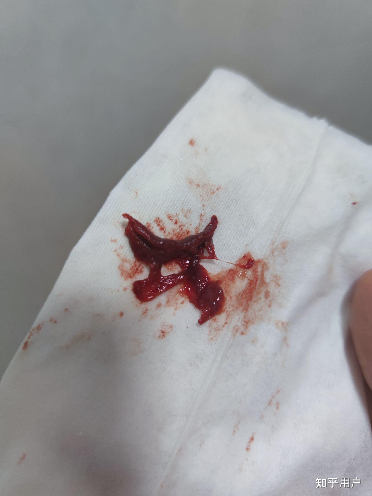 为什么每次月经掉一块很像肉一样的东西?