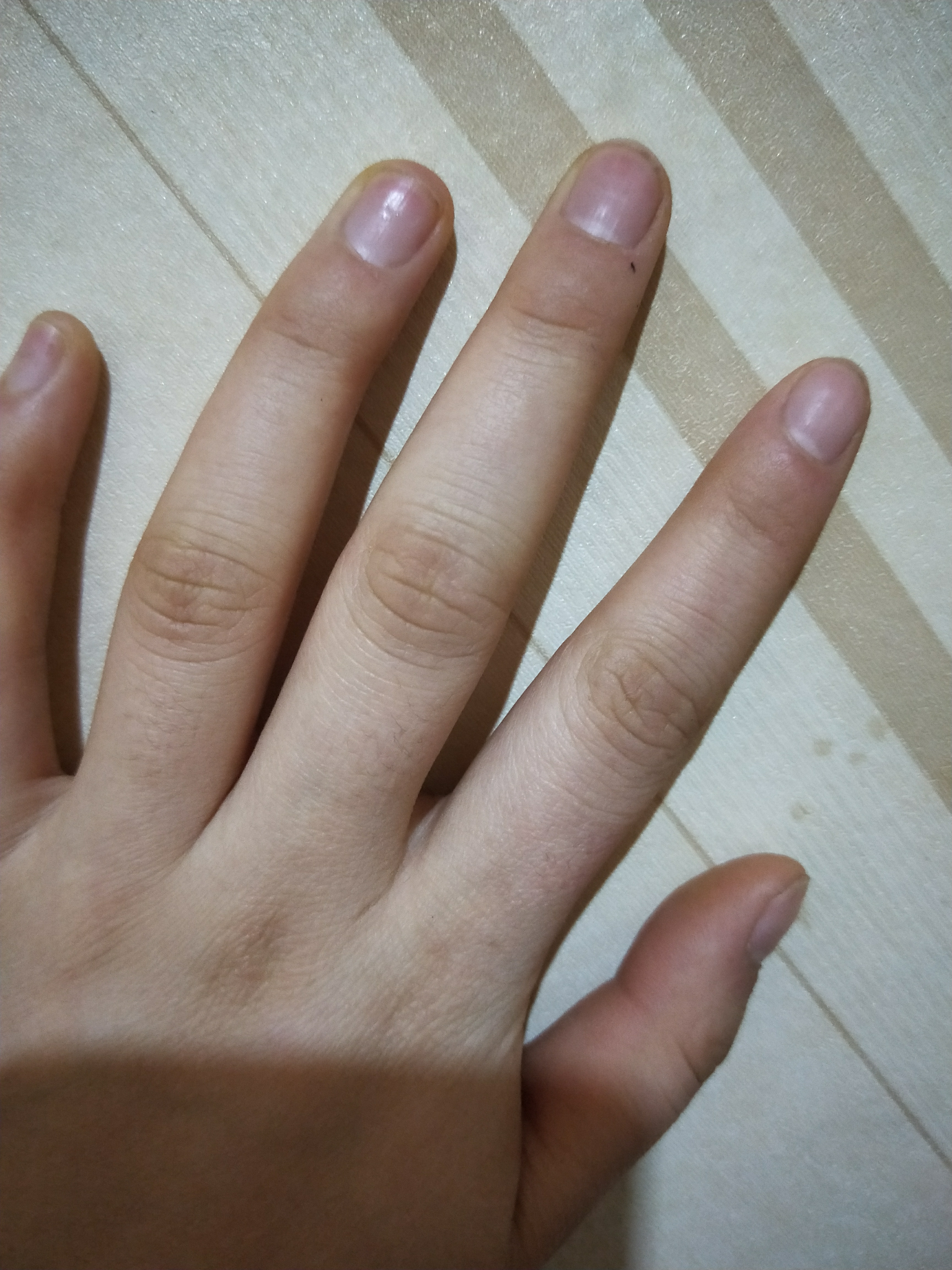 女生指关节发黑发硬怎么办