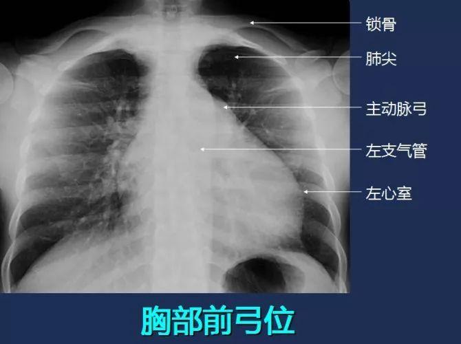 胸部创伤的评估与急救措施 - 知乎