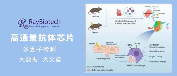 Raybio Nature Metabolism(IF:19.865)|RayBio抗体芯片助力脓毒症疾病发展机制研究 - 知乎