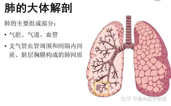 支气管肺炎严重吗? - 知乎