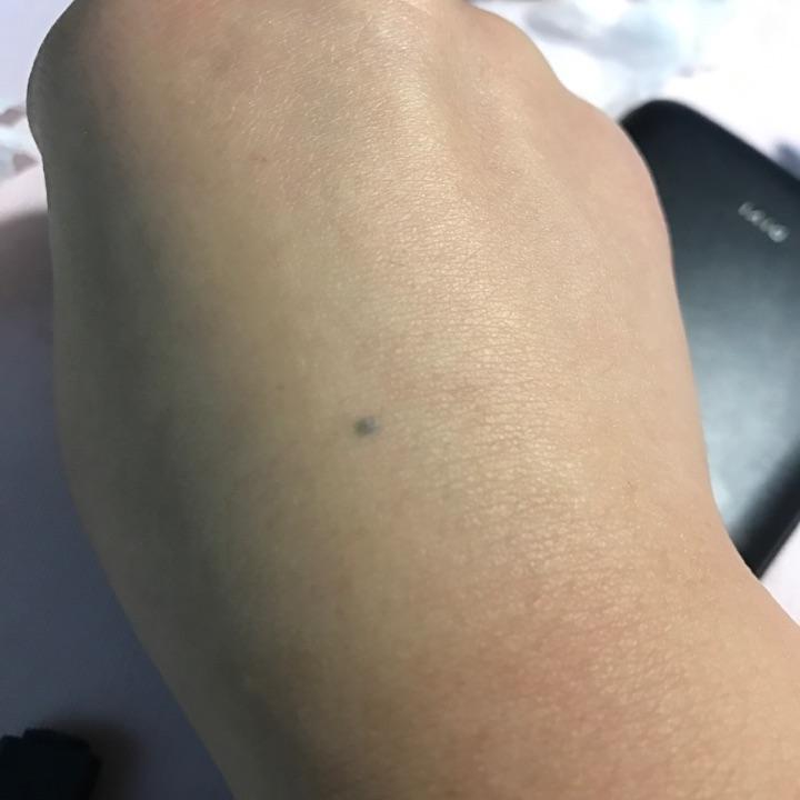 手上长了颗蓝色的痣我好方请懂的人帮我看一下好不好有问题