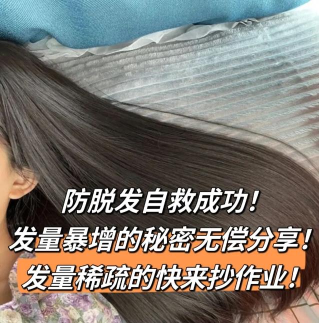 头发大把掉的朋友有福了!照着做,头发多到炸,再也不怕秃! - 知乎