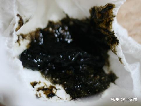 宝宝排便1天拉3次和3天拉1次怎么办