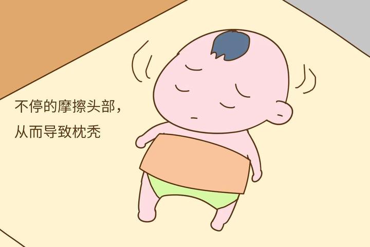宝宝出现枕秃是怎么回事? - 知乎