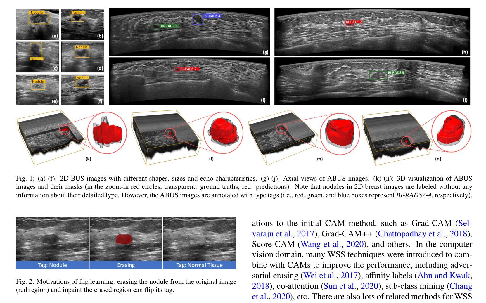 医学影像/Breast Ultrasound