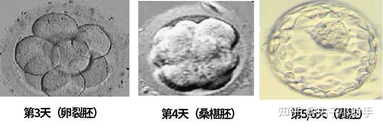 “颜值即正义?揭秘胚胎界的选美大赛!” - 知乎