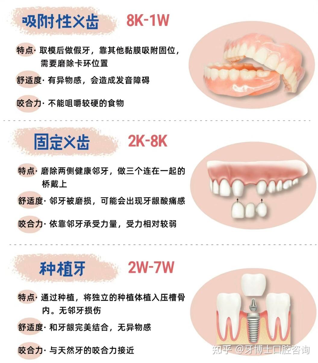 上海种植牙医院怎么选