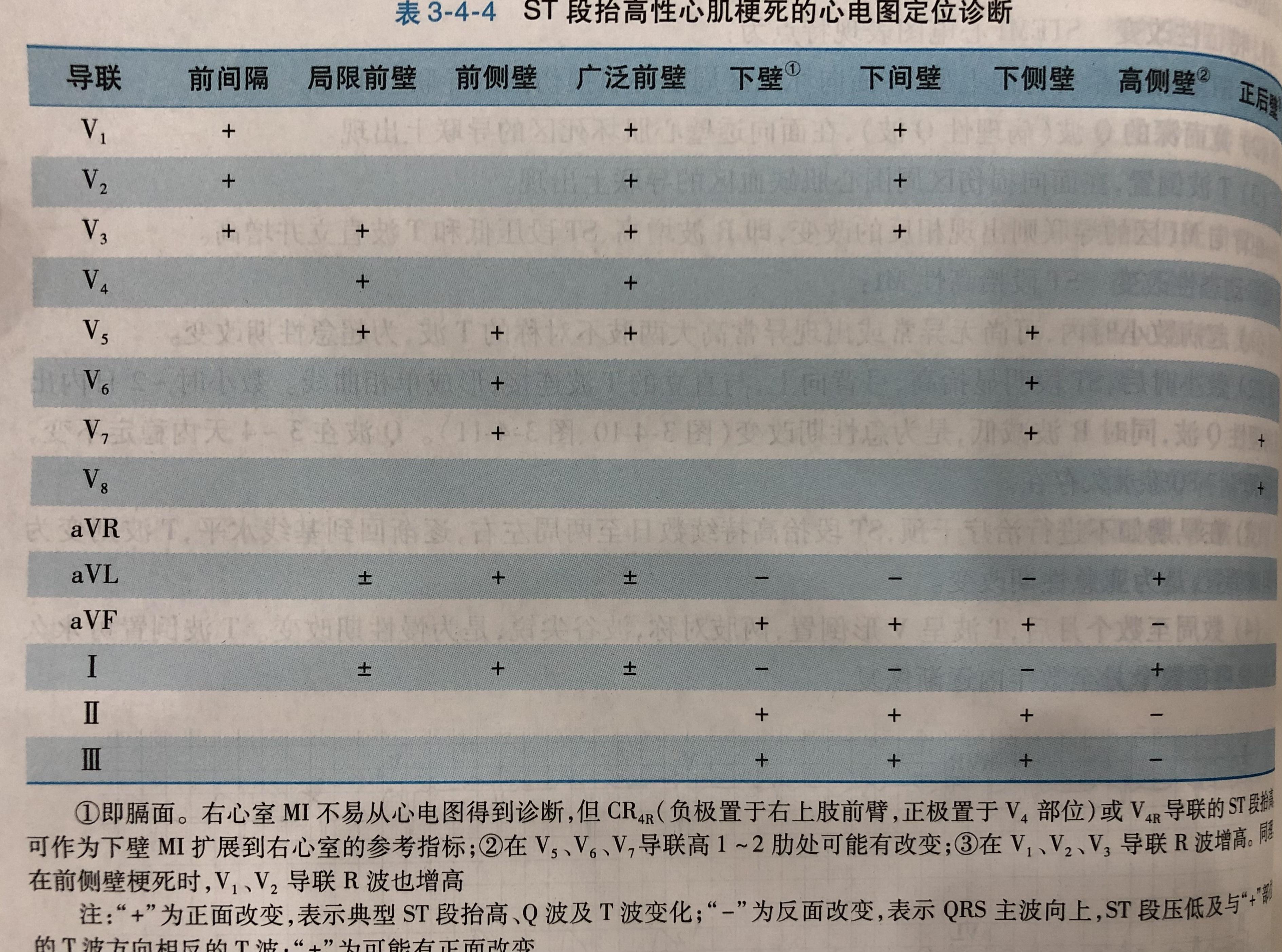 急性心肌缺血為什麼st段抬高t波高聳