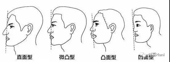 兩廣人長相稱為百越型(少數福建人也是百越型).