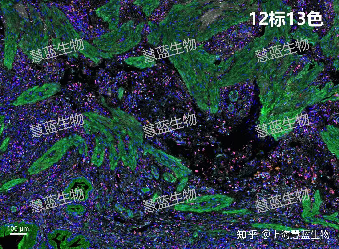 超多重整体解决方案（淬灭系统） - 知乎