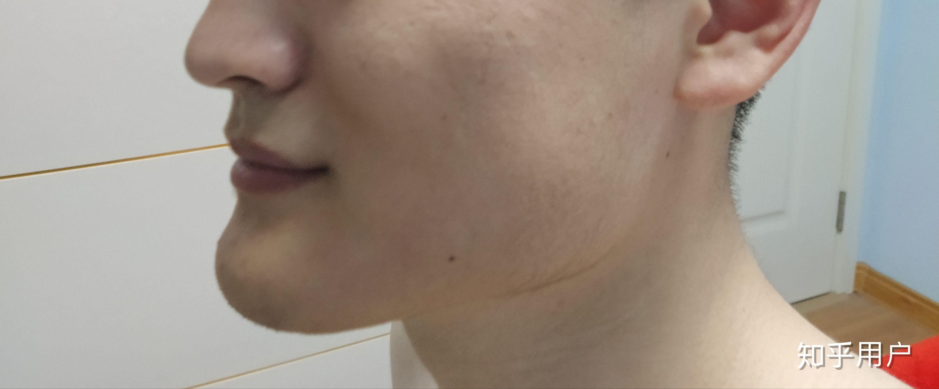 下巴过长且前突是一种怎样的体验？ 知乎 
