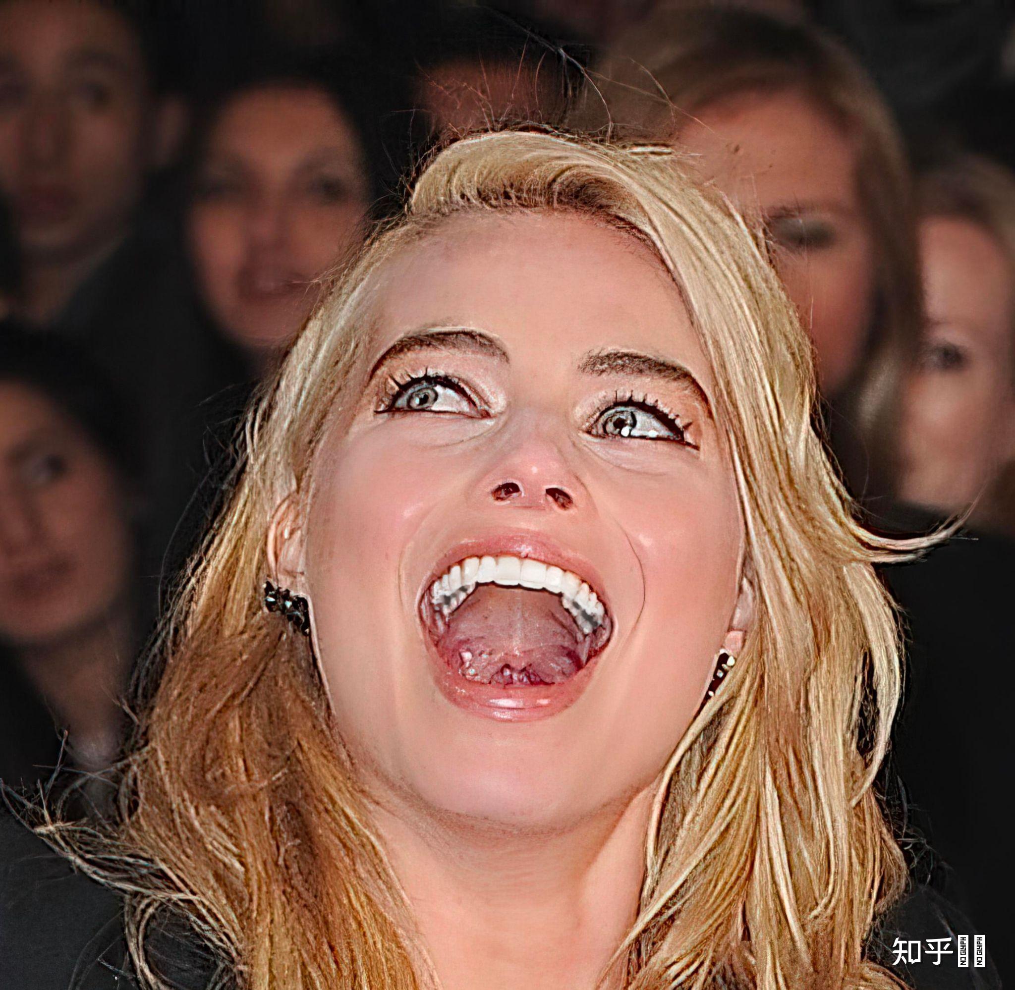 满口蛀牙是什么感觉? - 知乎