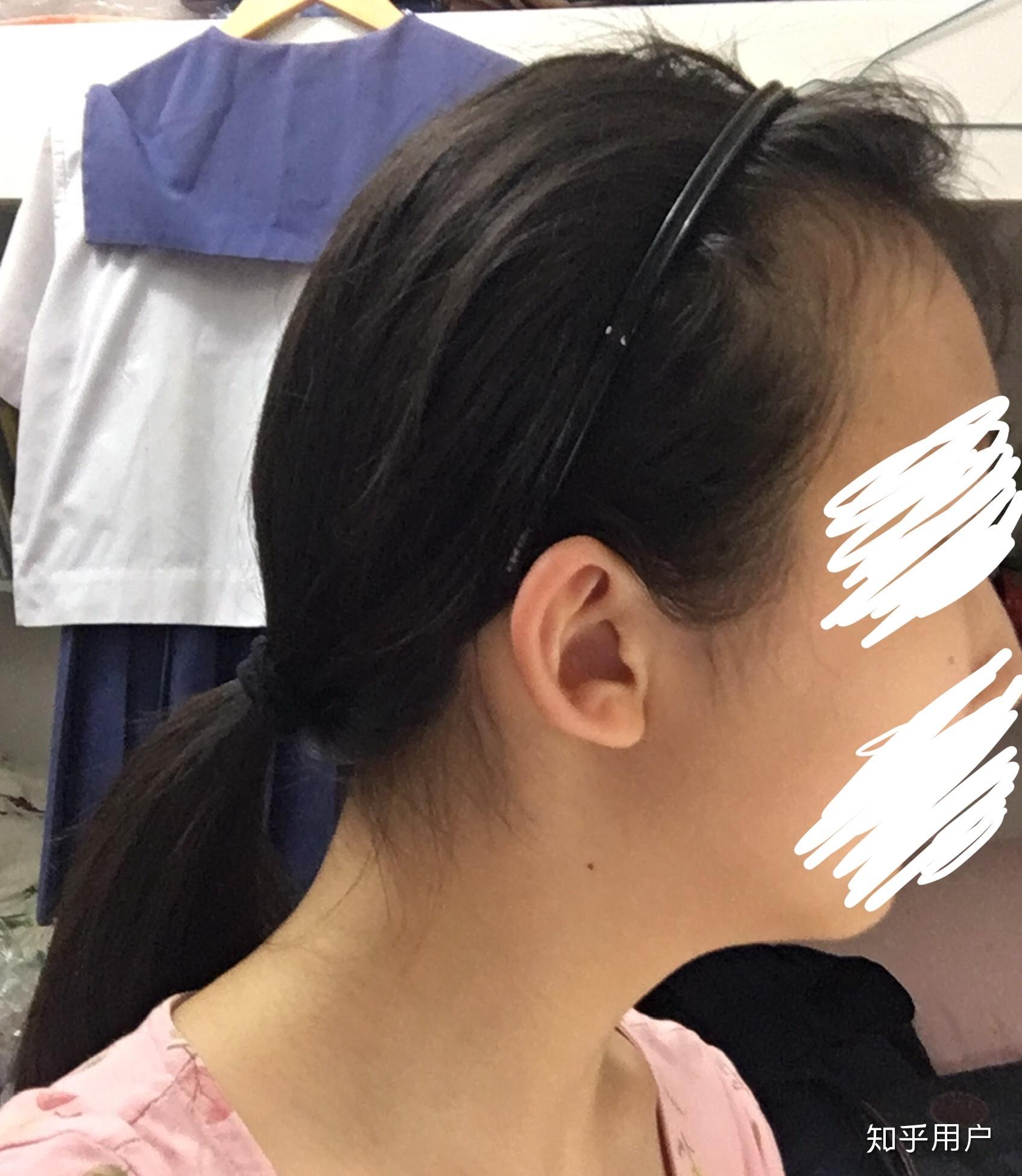 扁头,骨相不好看的女生如何改造自己?