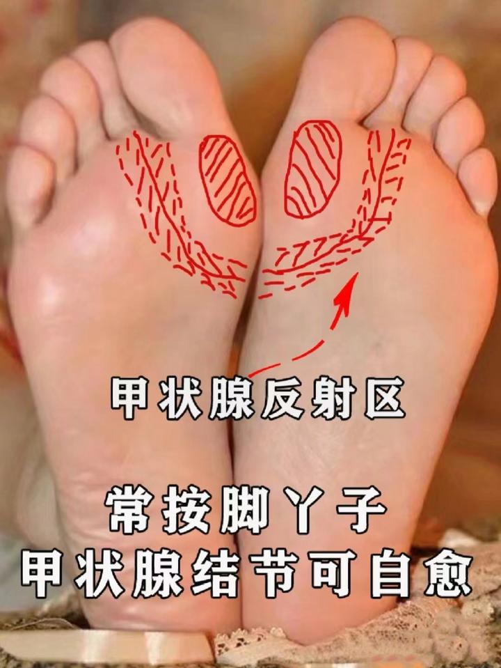 中医推荐：甲状腺反射区按摩手法，搭配中药调理，一个月见效果 知乎