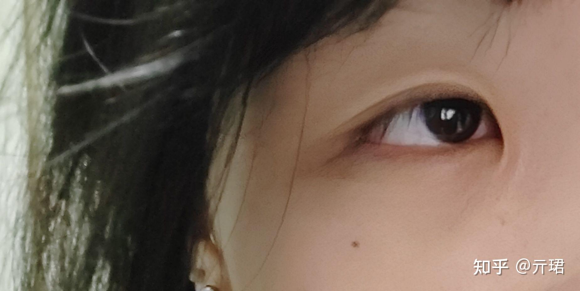 有眼尾沟的眼睛好看吗? - 知乎