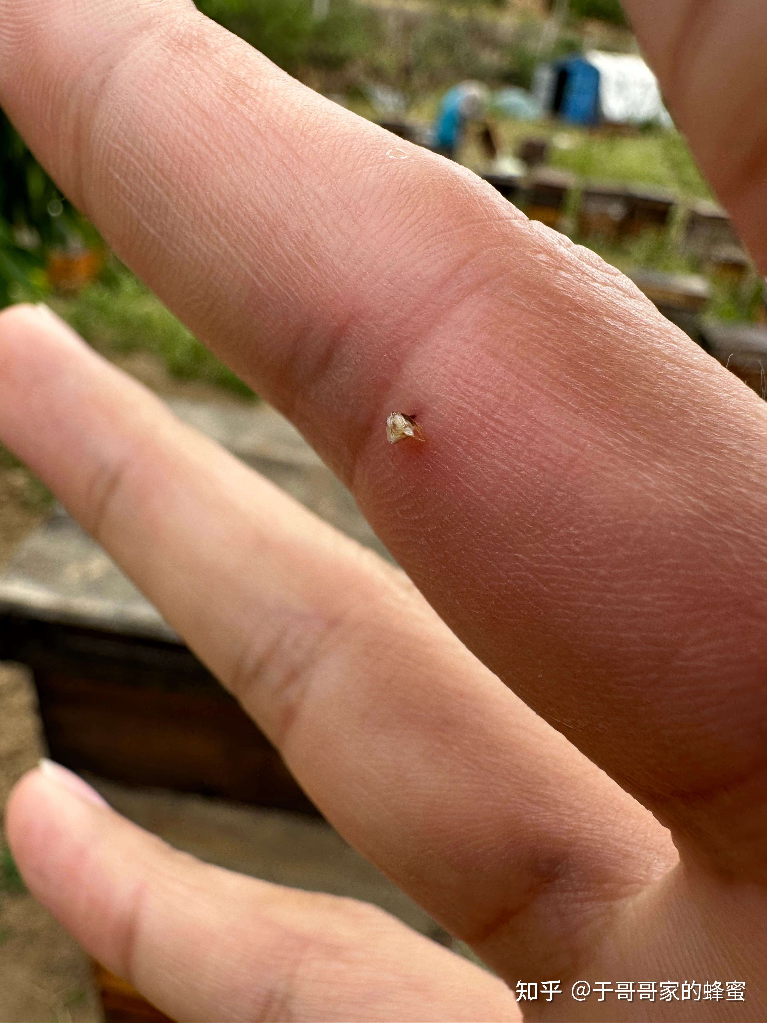 被蜜蜂蛰了真的会中毒吗?