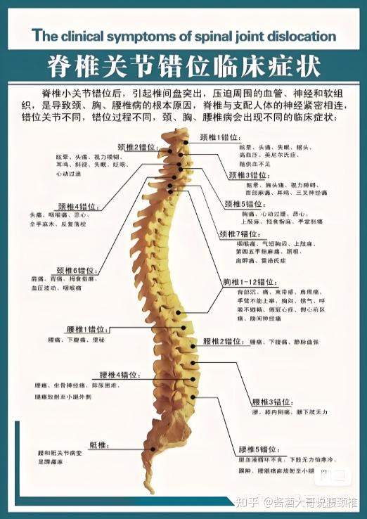 第六颈椎横突示意图图片