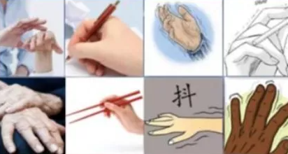 手抖震颤 - 知乎