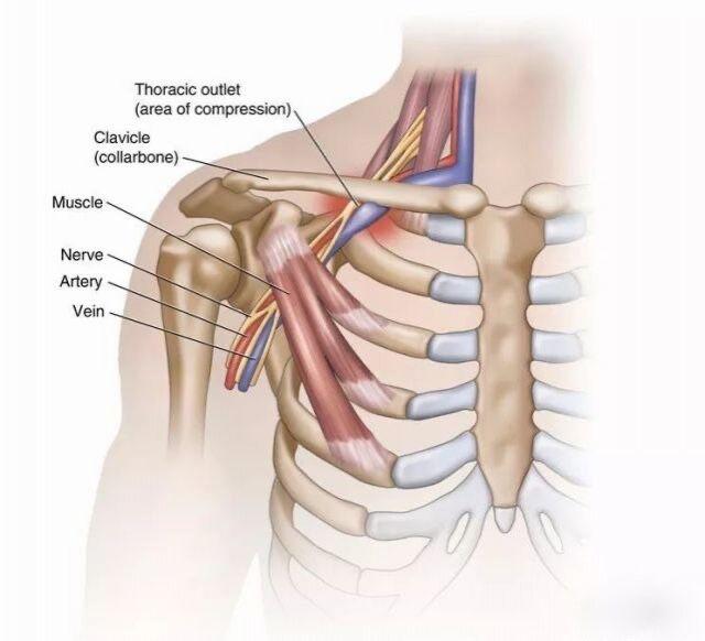 新生儿臂丛神经损伤原因