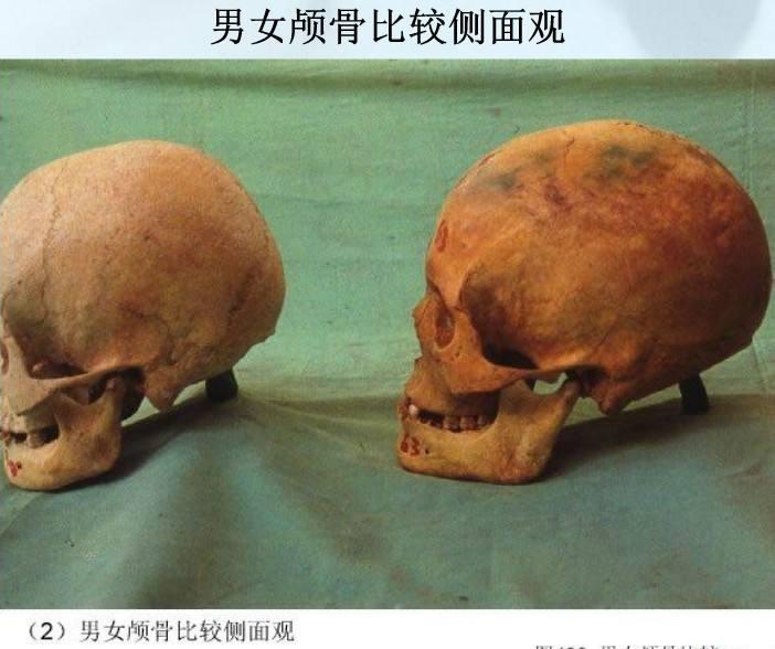 如何通过骨骼判断死者的性别及死亡时的大致年龄? - 知乎