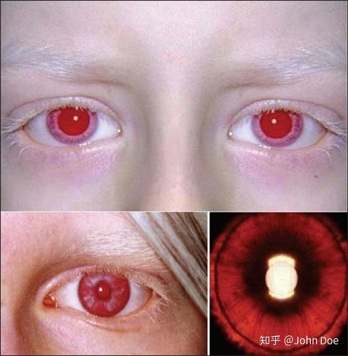 怎样可以永久改变瞳色