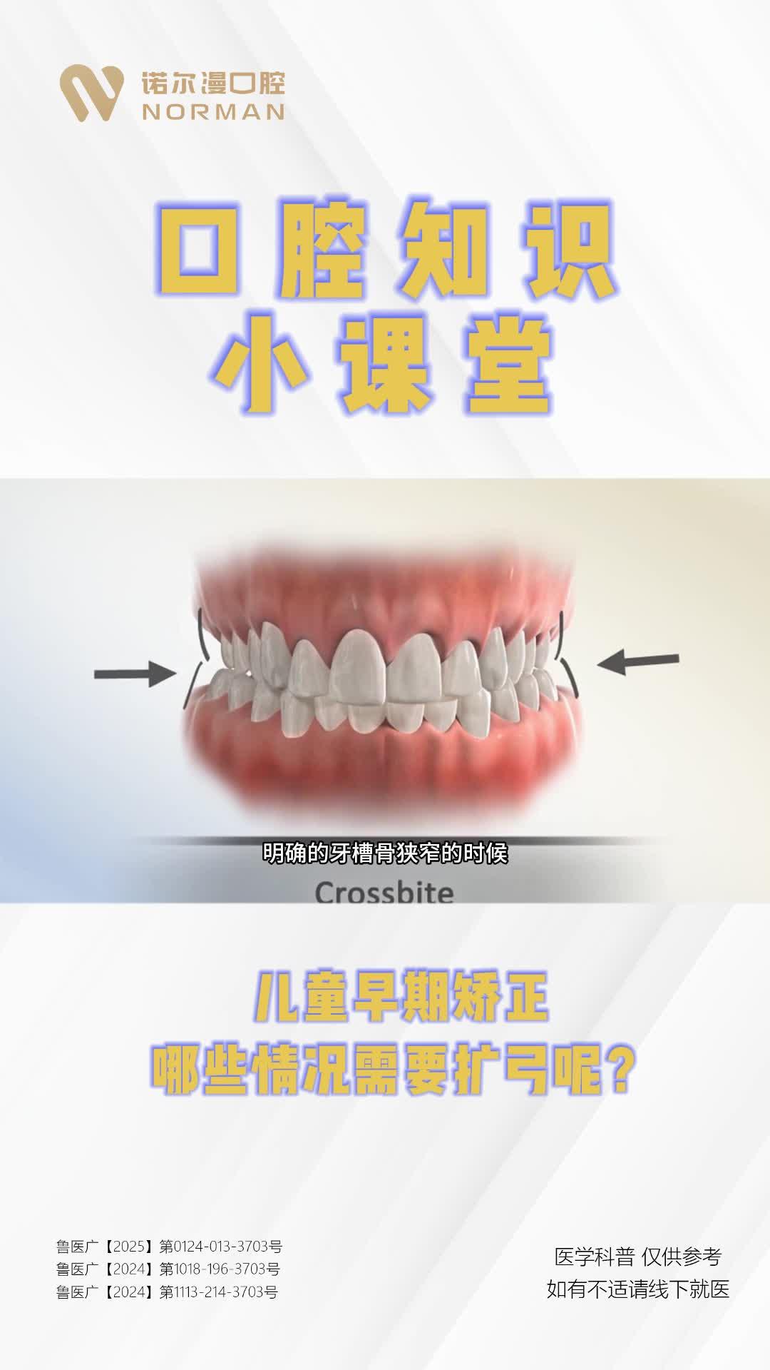 扩弓矫正的生死线|儿童正畸必须避开的三大雷区 - 知乎