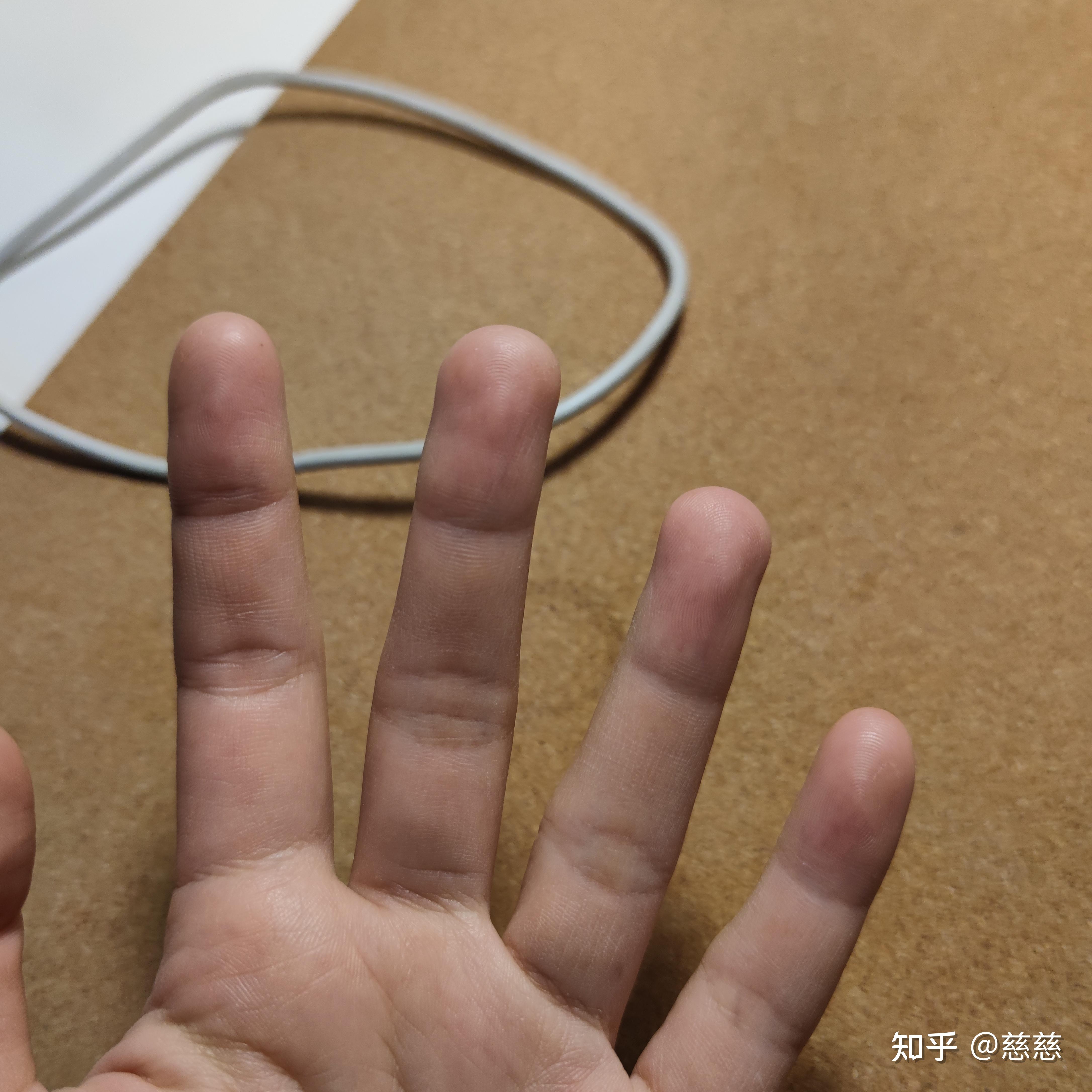 弹古筝用的甲片绑久了对手指头会有害吗?