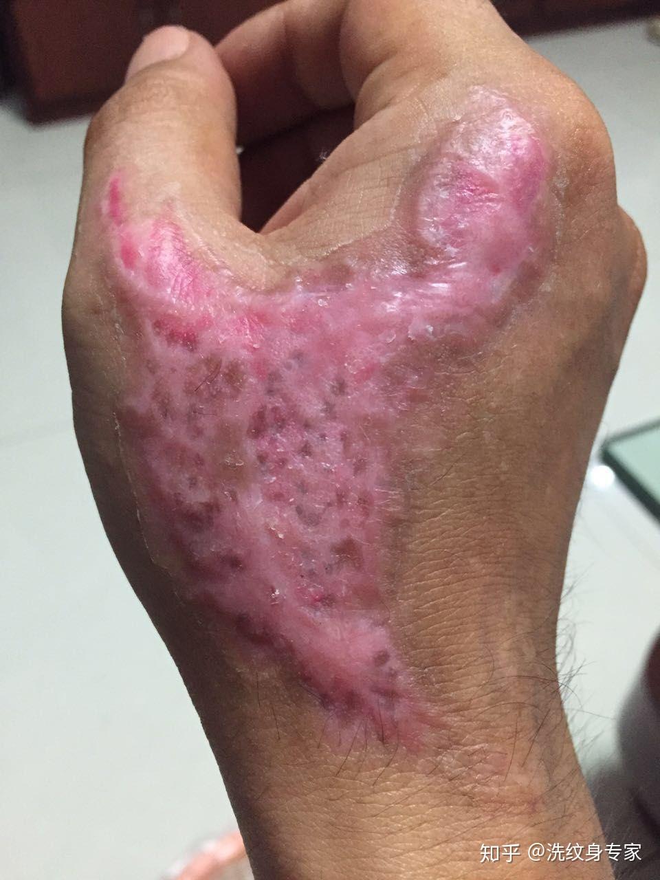 满背纹身可以洗干净吗