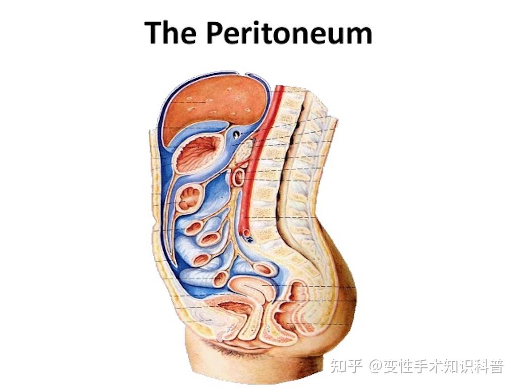 变性手术模具曝光图片