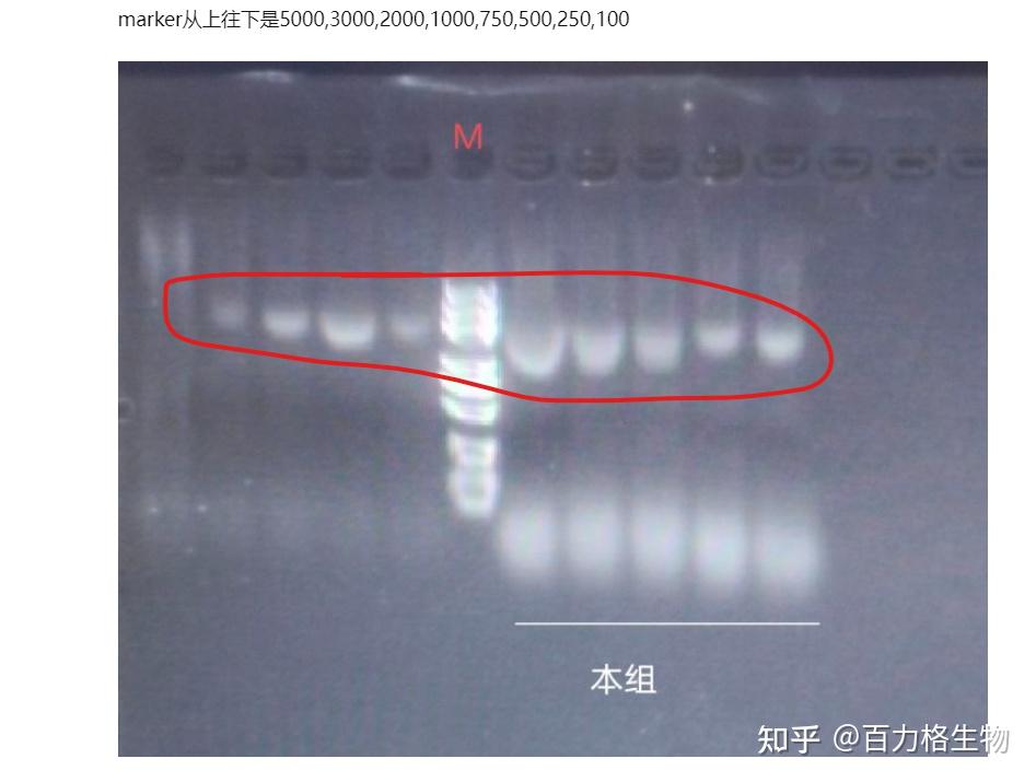 pcr电泳图详细分析图片