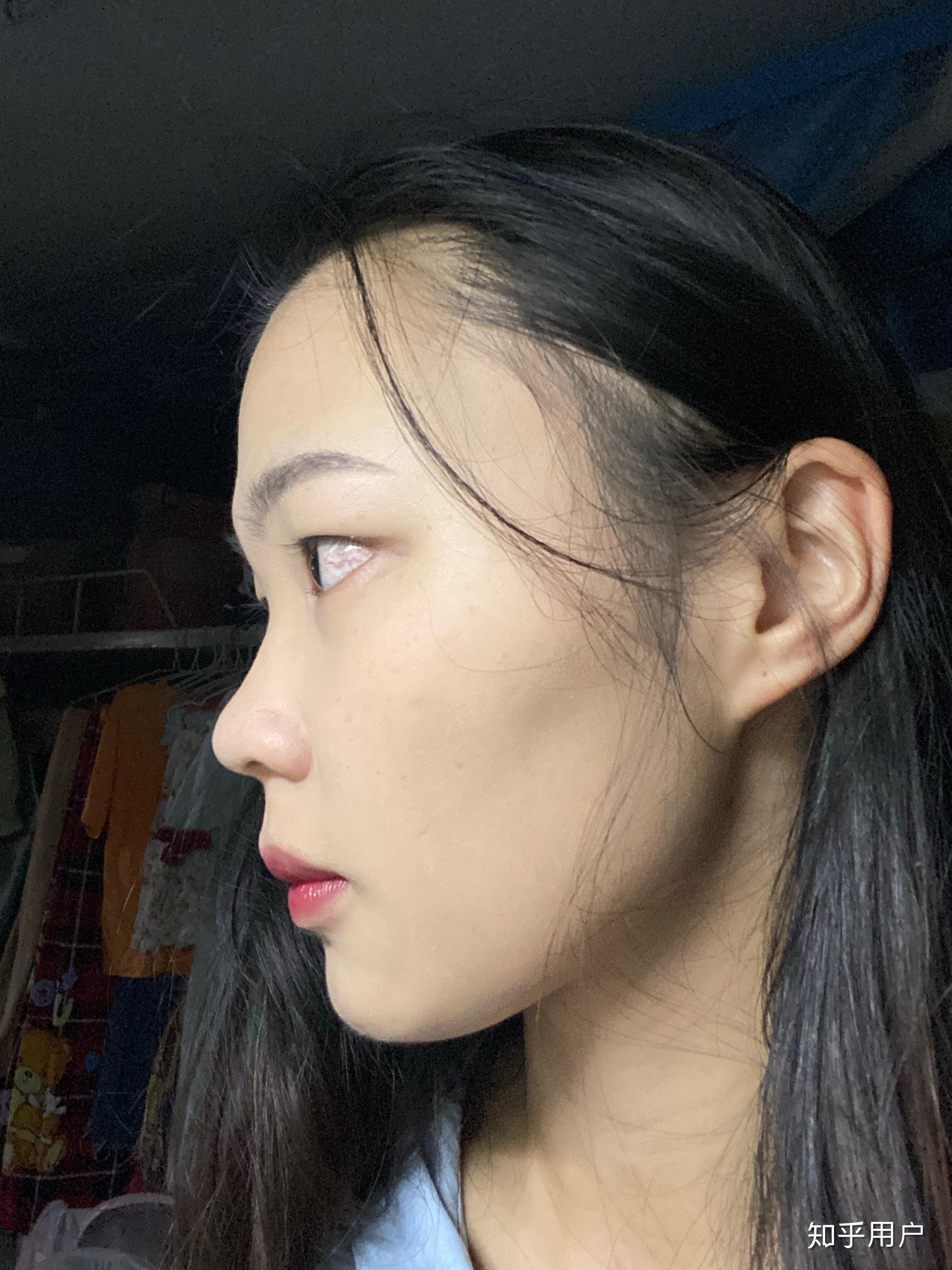 没有鼻梁鼻子塌的人是什么体验