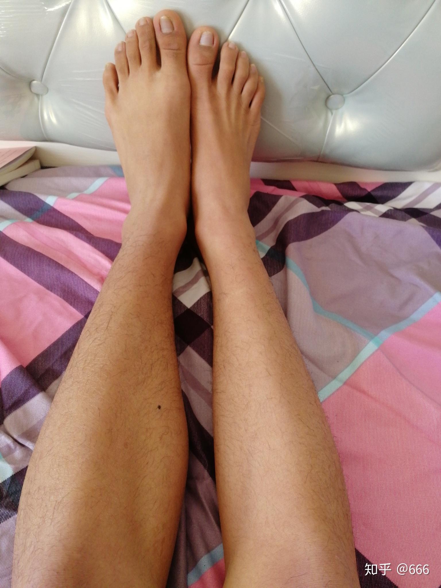 左右小腿不一样粗应该是因为肌肉的形状或者是维度不一样困扰很久了各