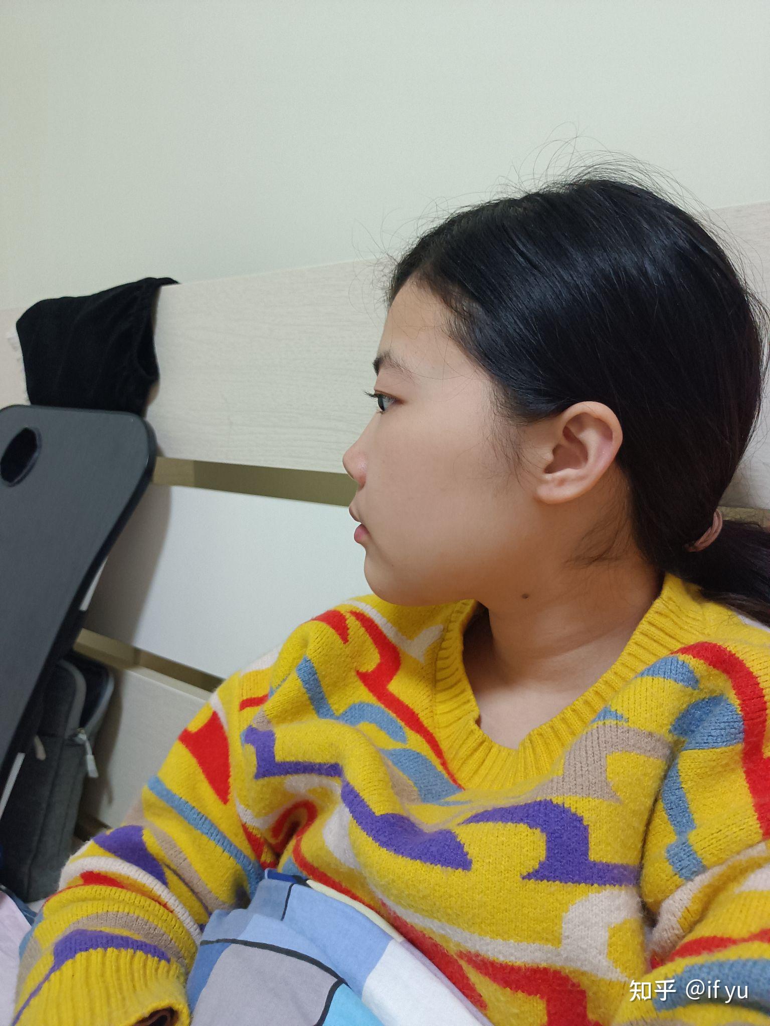 正脸好看但侧脸丑到爆是种怎样的体验? - 知乎