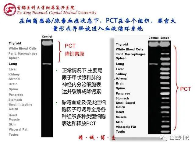 工艺管理：pct检测原理和溯源性 - 知乎