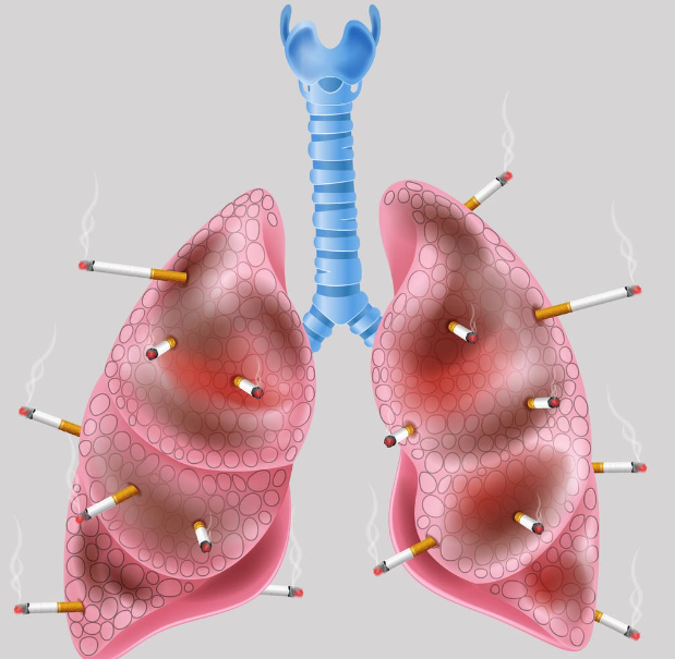 肺有6怕你知道几个