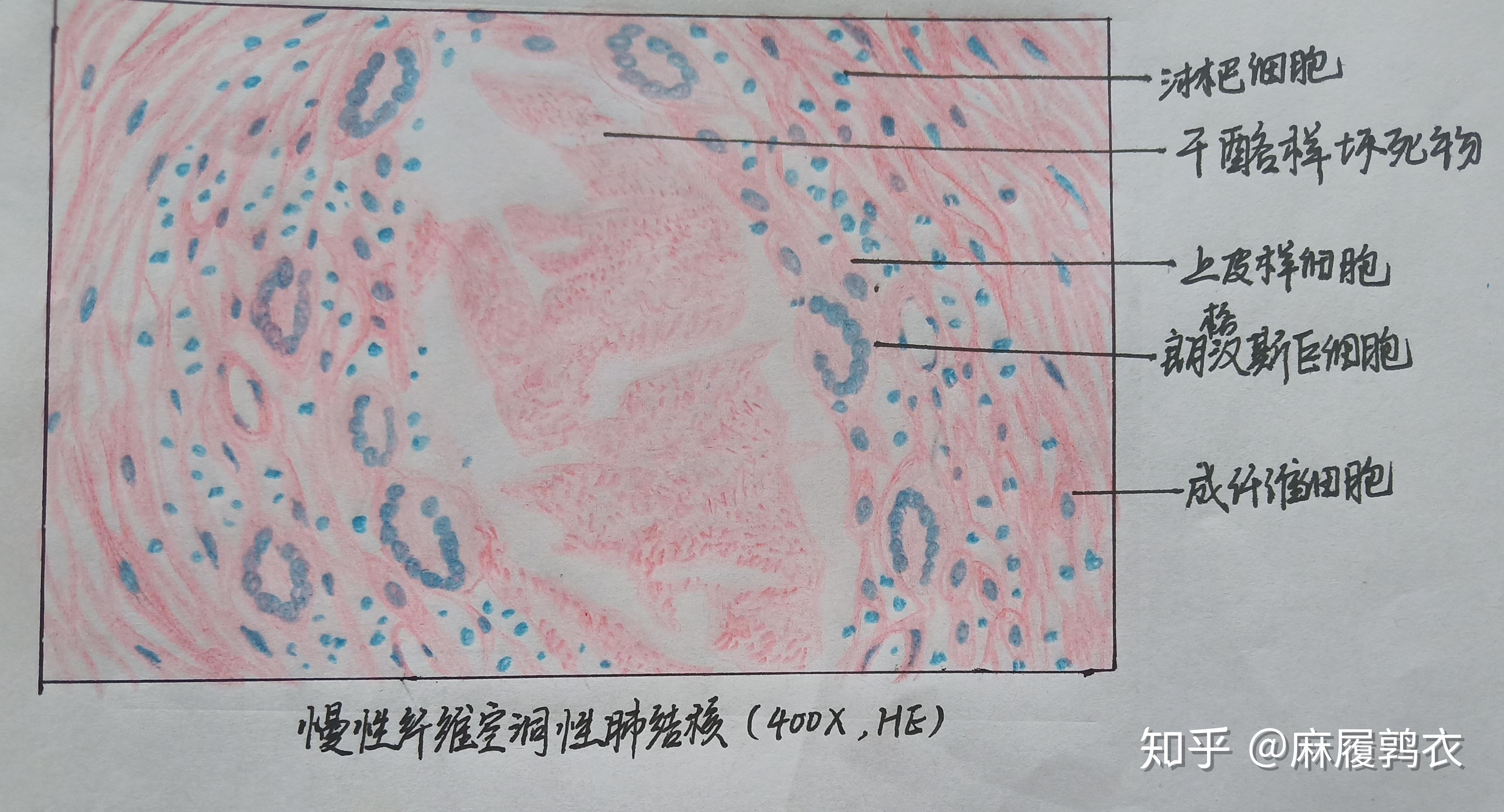 为什么咱们不弄个病理红蓝手绘图的问题呢