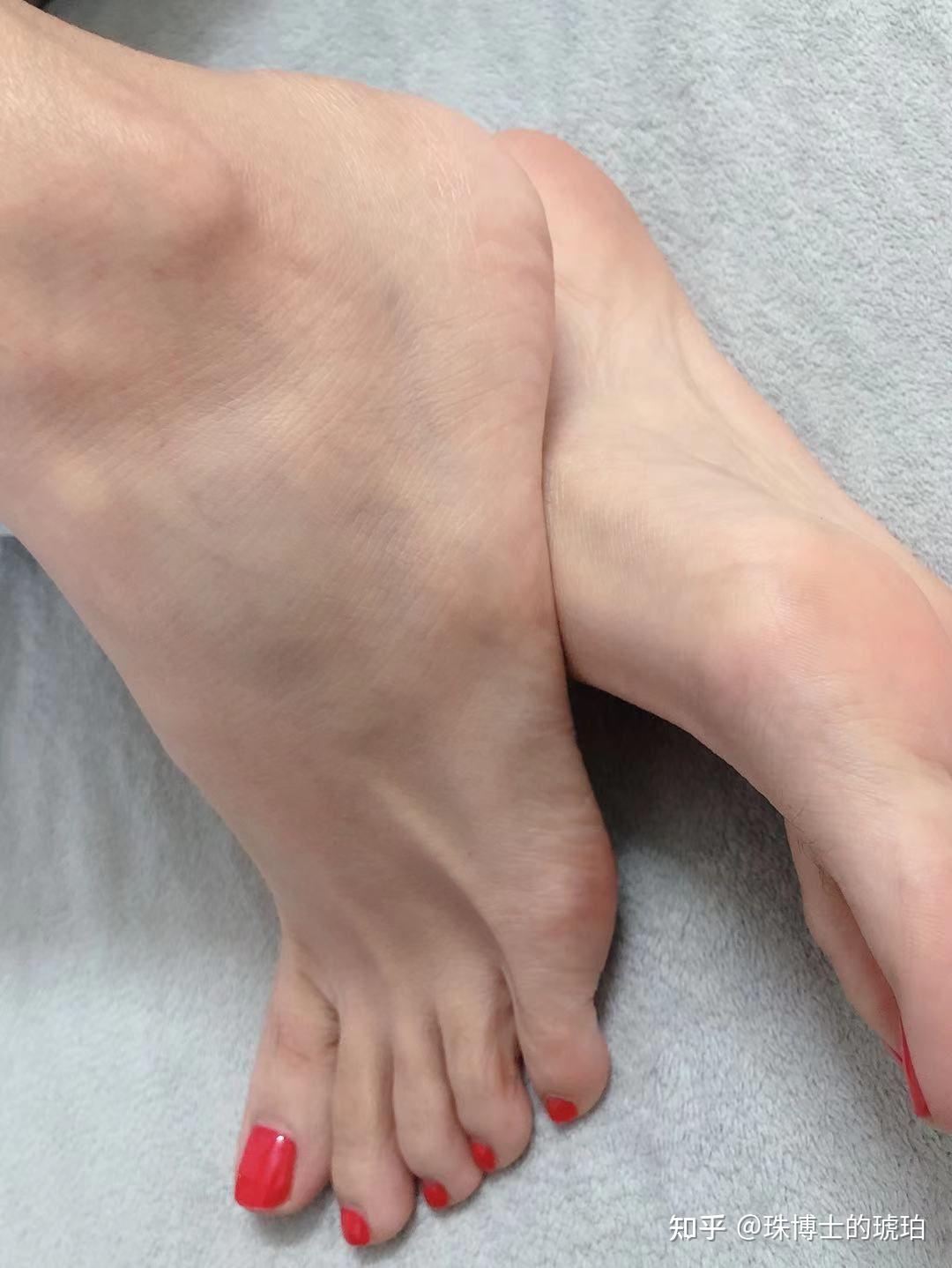 高脚背判断?